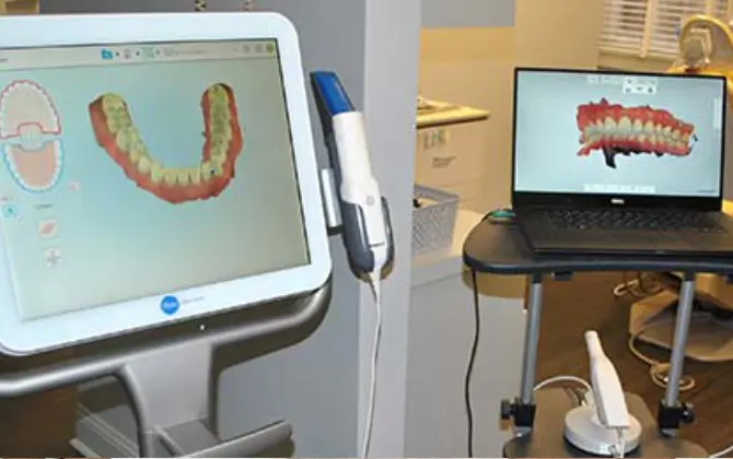 itero imaging system
