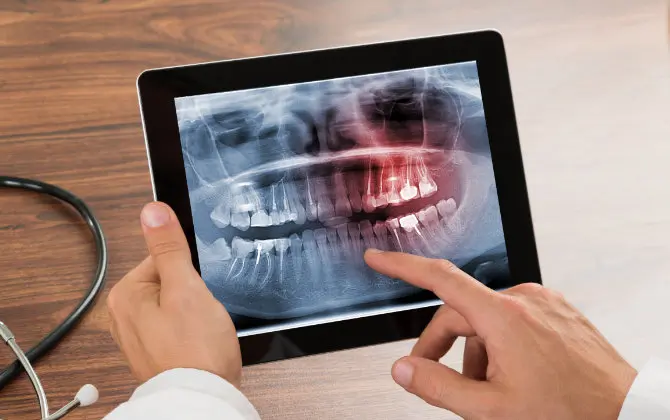 Digital Dental X-Rays